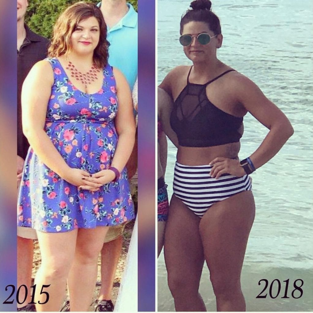 Woman before and after side by side weight loss transformation difference from 2015 to 2018